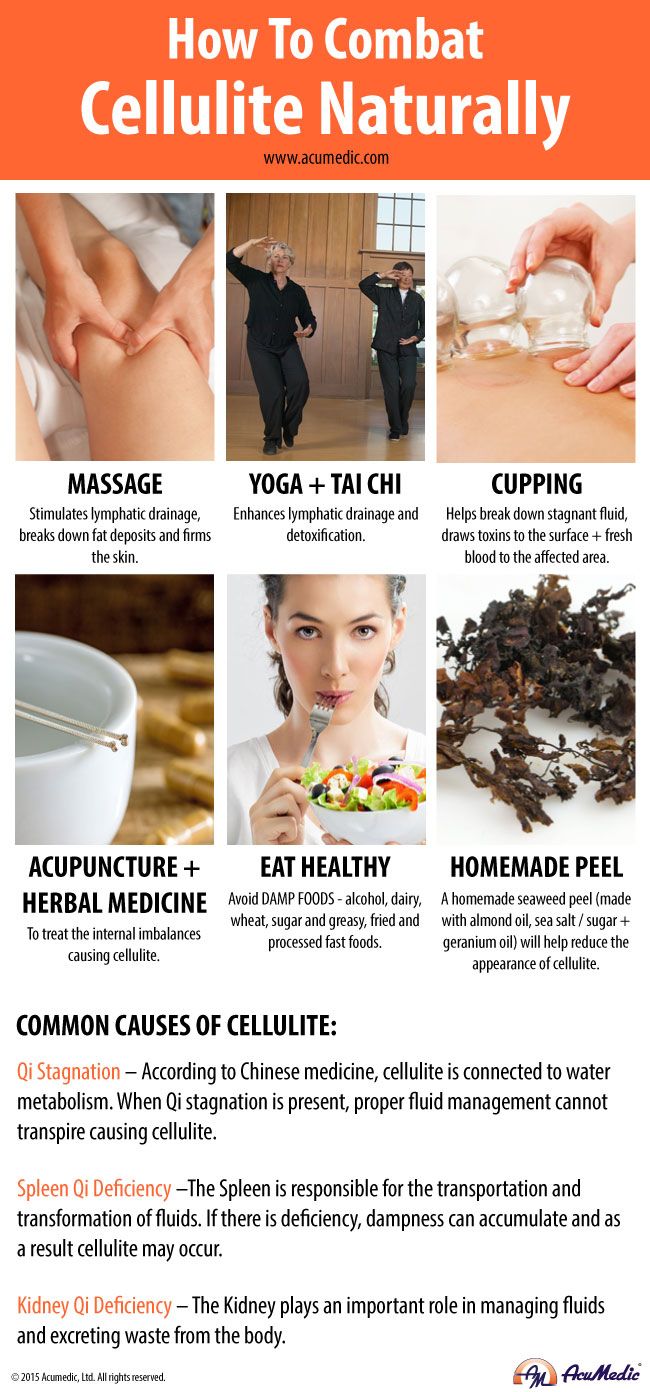 Natural cellulite remedies