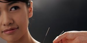 Acupuncture discount for our existing clients only