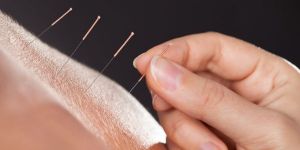 Your next acupuncture CPD course
