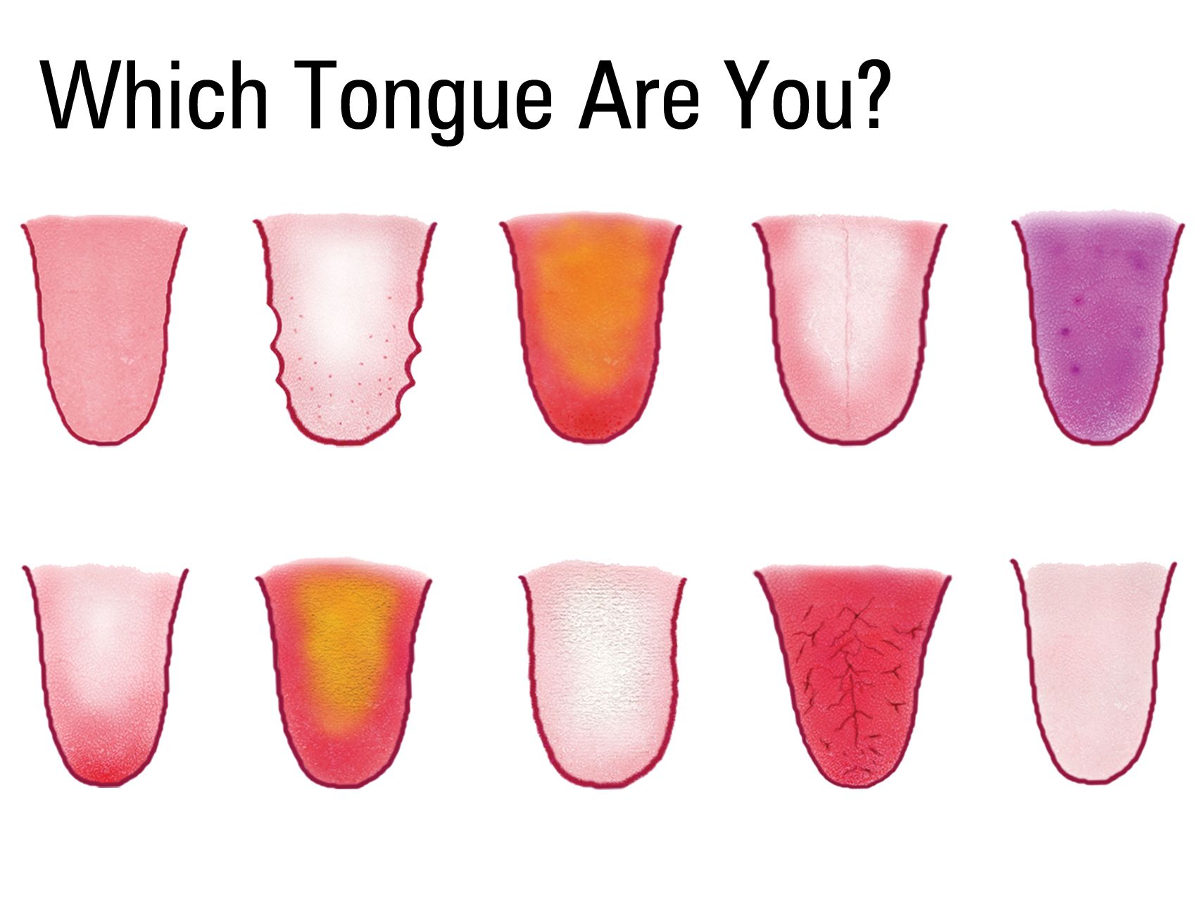 basic-tongue-diagnosis-acumedic-clinic