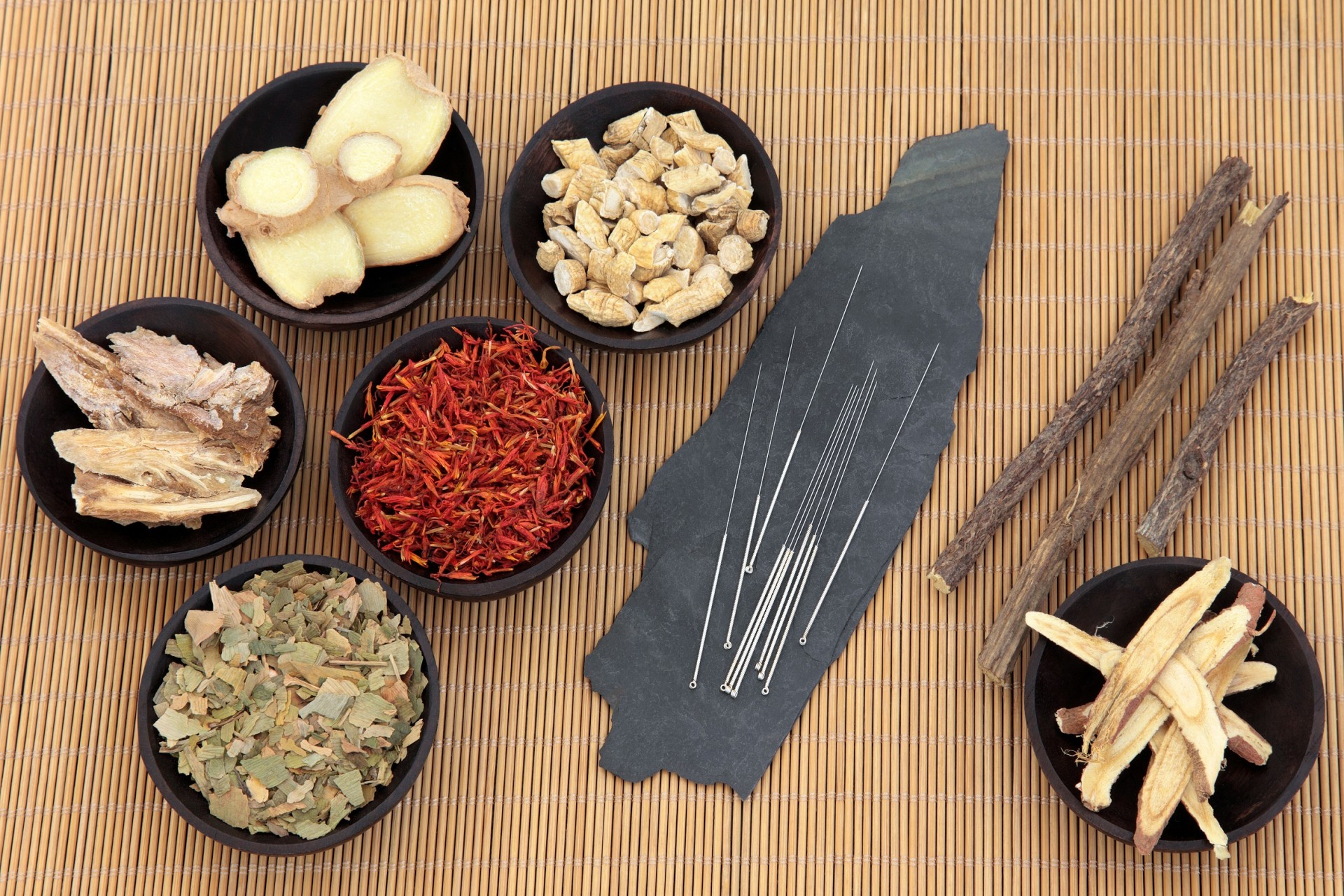 Acupuncture & Full Chinese Herbal Consultation