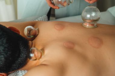 Image: Why are Olympians going crazy for cupping?