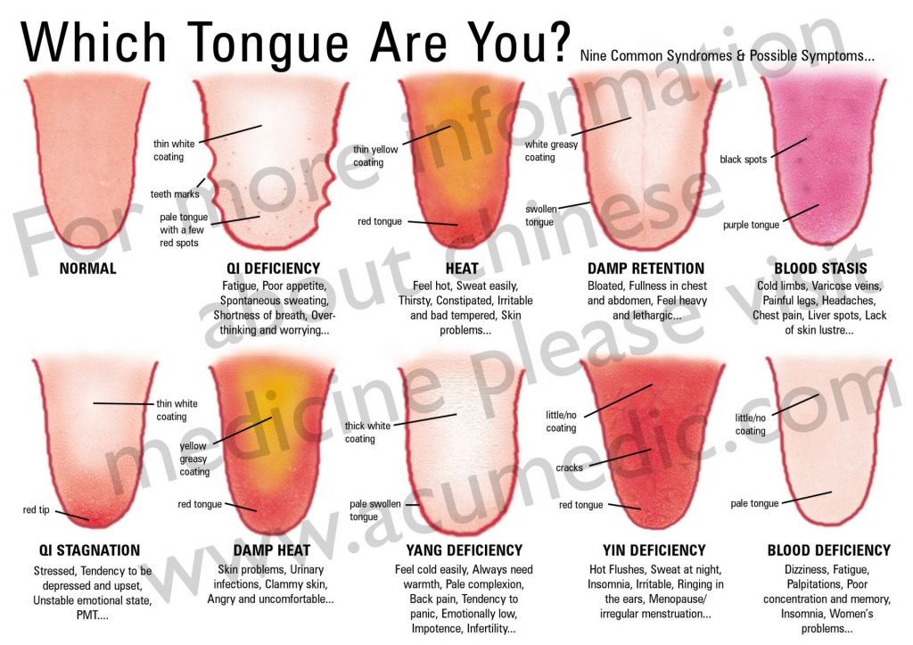 Chinese medicine tongue diagnosis chart